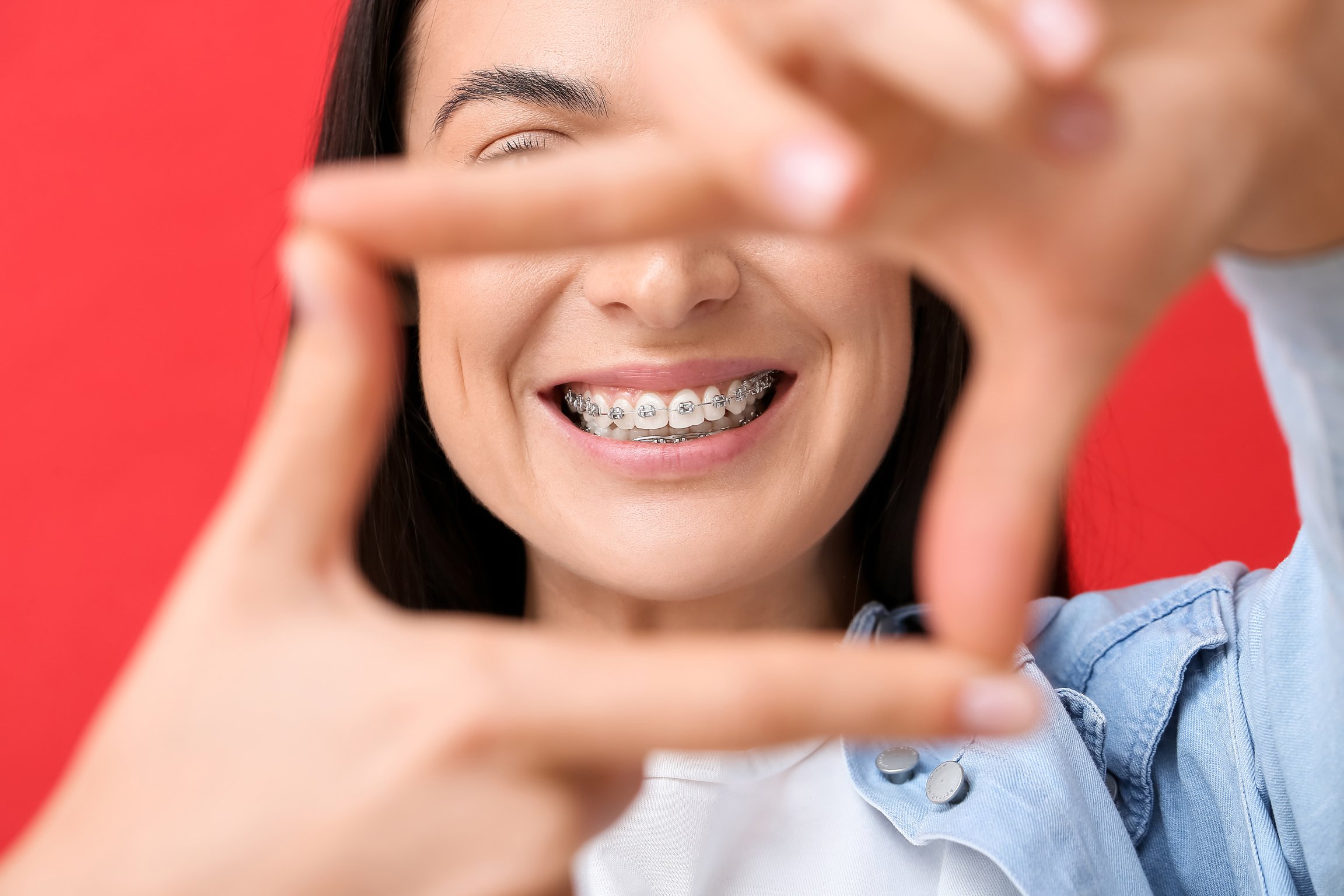 Beautiful Woman with Dental Braces on Red Background, Closeup